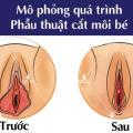 cat-moi-be-cong-nghe-han-quoc-100-chi-em-ung-y-sau-khi-lam-thu-thuat