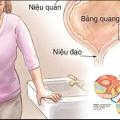 top-5-phong-kham-chua-benh-viem-nieu-dao-tot-nhat-ha-noi