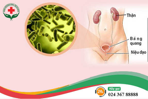 Nhiễm khuẩn đường tiết niệu là bệnh lý rất nhiều nữ giới gặp phải