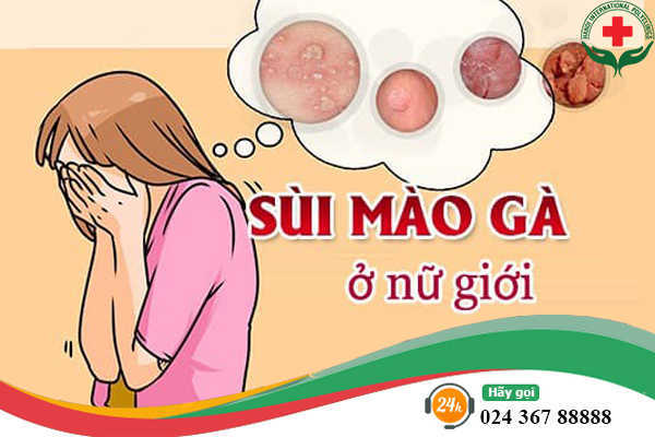 Bệnh sùi mào gà gây vùng kín có mùi ở nữ giới