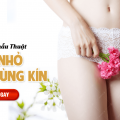 chi-phi-phau-thuat-thu-nho-vung-kin-la-bao-nhieu