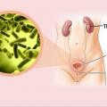tim-hieu-nguyen-nhan-trieu-chung-va-cach-chua-benh-nhiem-trung-duong-tieu