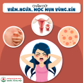 noi-mun-o-vung-kin-nu-la-benh-gi-va-cach-chua-tri-hieu-qua
