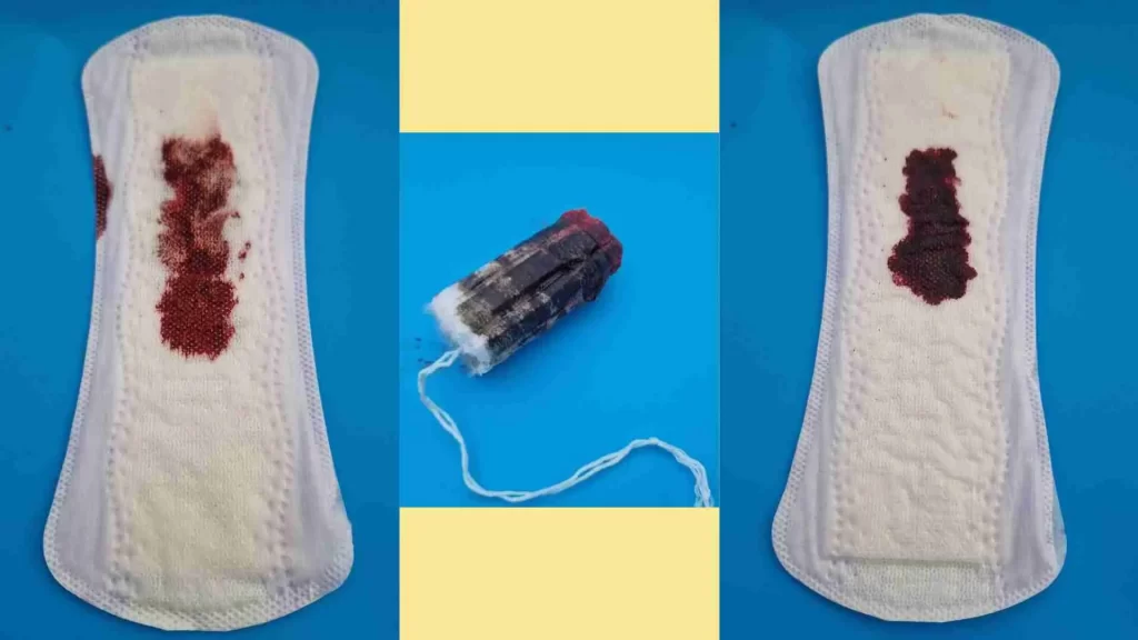 Âm đạo chảy máu đen