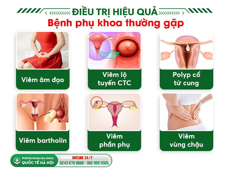Điều trị hiệu quả bệnh phụ khoa thường gặp
