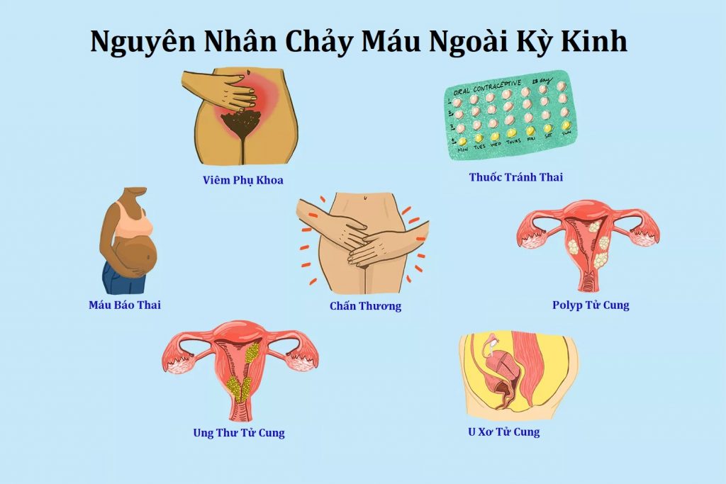 nguyên nhân chảy máu ngoài kỳ kinh