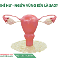 khi-hu-ngua