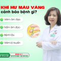 khi-hu-mau-vang