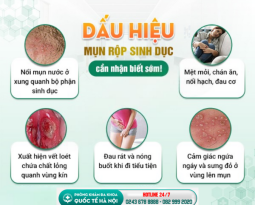 mun-rop-sinh-duc-co-the-deo-bam-ban-ca-doi-nhan-biet-som-de-dieu-tri-hieu-qua