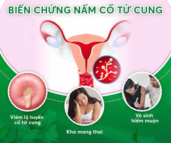 nam-co-tu-cung