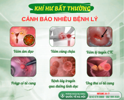 vung-kin-chay-ra-dich-co-mui-hoi