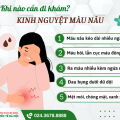 kinh-nguyet-mau-nau-dau-hieu-benh-ly-nhung-gan-80-phu-nu-phot-lo