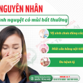 kinh-nguyet-co-mui