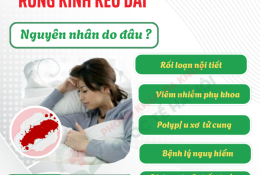 rong-kinh-keo-dai-vai-ngay