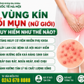 am-dao-noi-mun-la-benh-gi