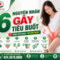 nguyen-nhan-gay-tieu-buot