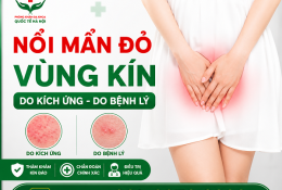 noi-man-do-vung-kin